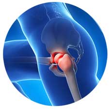 Regenerative Hip Treatments
